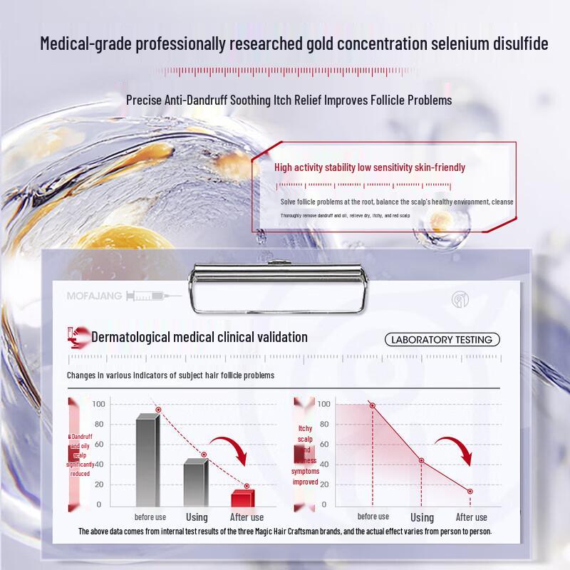 Three Hair Wizards Selenium Sulfide Oil Control Anti-Dandruff Shampoo