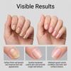 Nail care gel, nourishes the surface of nails and promotes daily care.