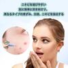 Roczential 100 Blackhead Removal Acne Pore ABS Easy To Disposable Beauty Tool Tools, Needles, Care, Material, Use, Portable, (Blue)
