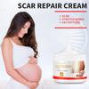 Removal Acne Scar Stretch Marks Cream Fat Scar  Treatment