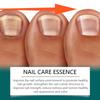 Nail Treatment Solution Cuticle Oil Repaired Dryness Damaged Toenail Moisturizes Strengthener Nails Care Enhancing Natural Shine