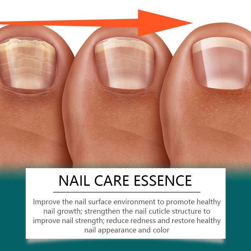 Nail Treatment Solution Cuticle Oil Repaired Dryness Damaged Toenail Moisturizes Strengthener Nails Care Enhancing Natural Shine