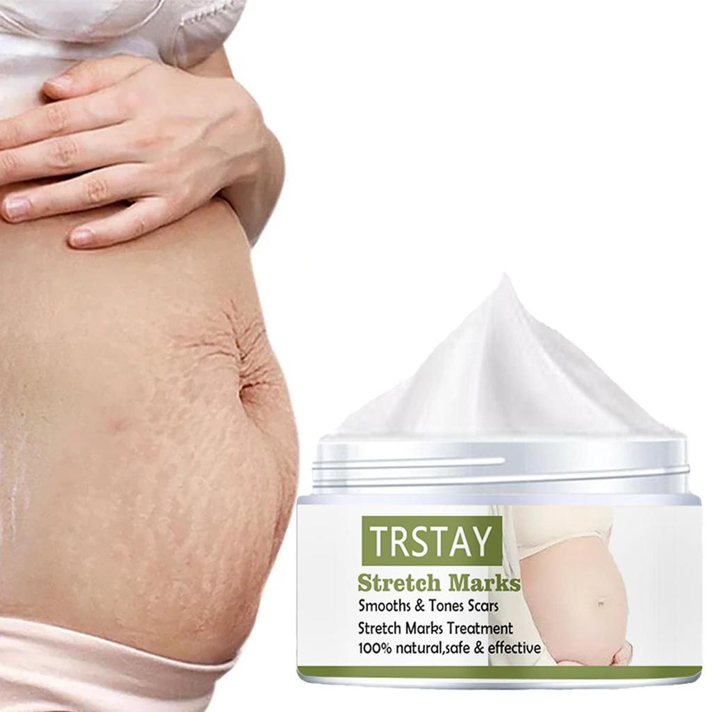 Jemné bez podráždění sprej na strie Odstranění strií po akné Krém na jizvy na strie Striae Gravidarum
