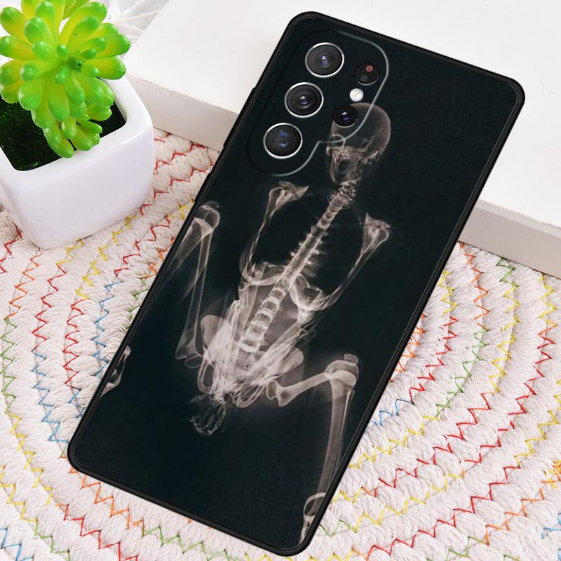 X-Ray Human Anatomy TPU Phone Case For Samsung Galaxy Note 10 Pro S26 S25 S24 S23 S22 Ultra Plus S21 FE S20 Shockproof Cover
