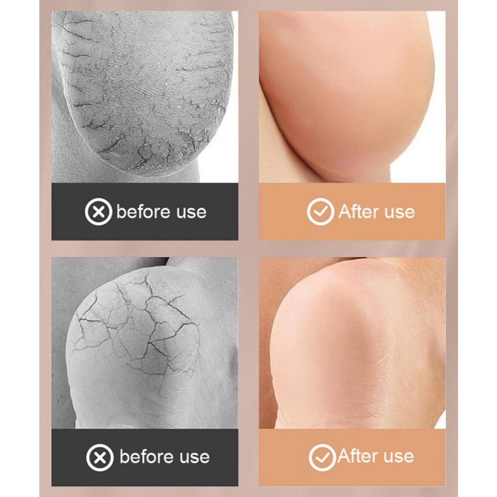 Heel Moisturizing Sleeves 1 Pair Heel Skin Moisturizing Cover Exfoliating Soften Heel Cover Heel Support For Women Men