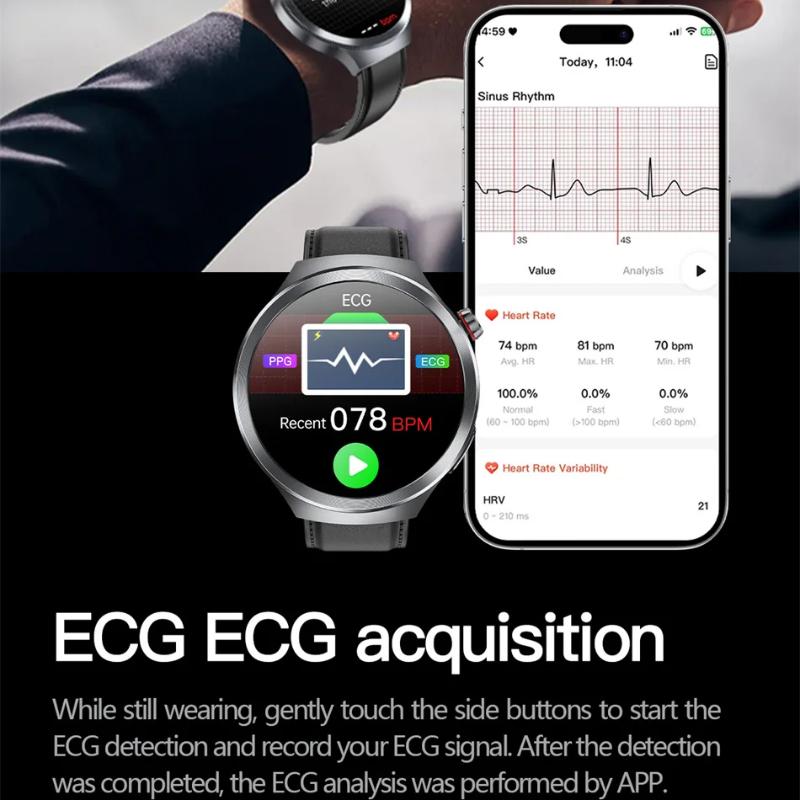 2025 Yeni Ürik Asit Kan Basıncı Kan Oksijeni Vücut Analizi Akıllı Saat EKG+PPG Saat Bluetooth Çağrı Akıllı Saat Erkekler Yorgunluk İzleme