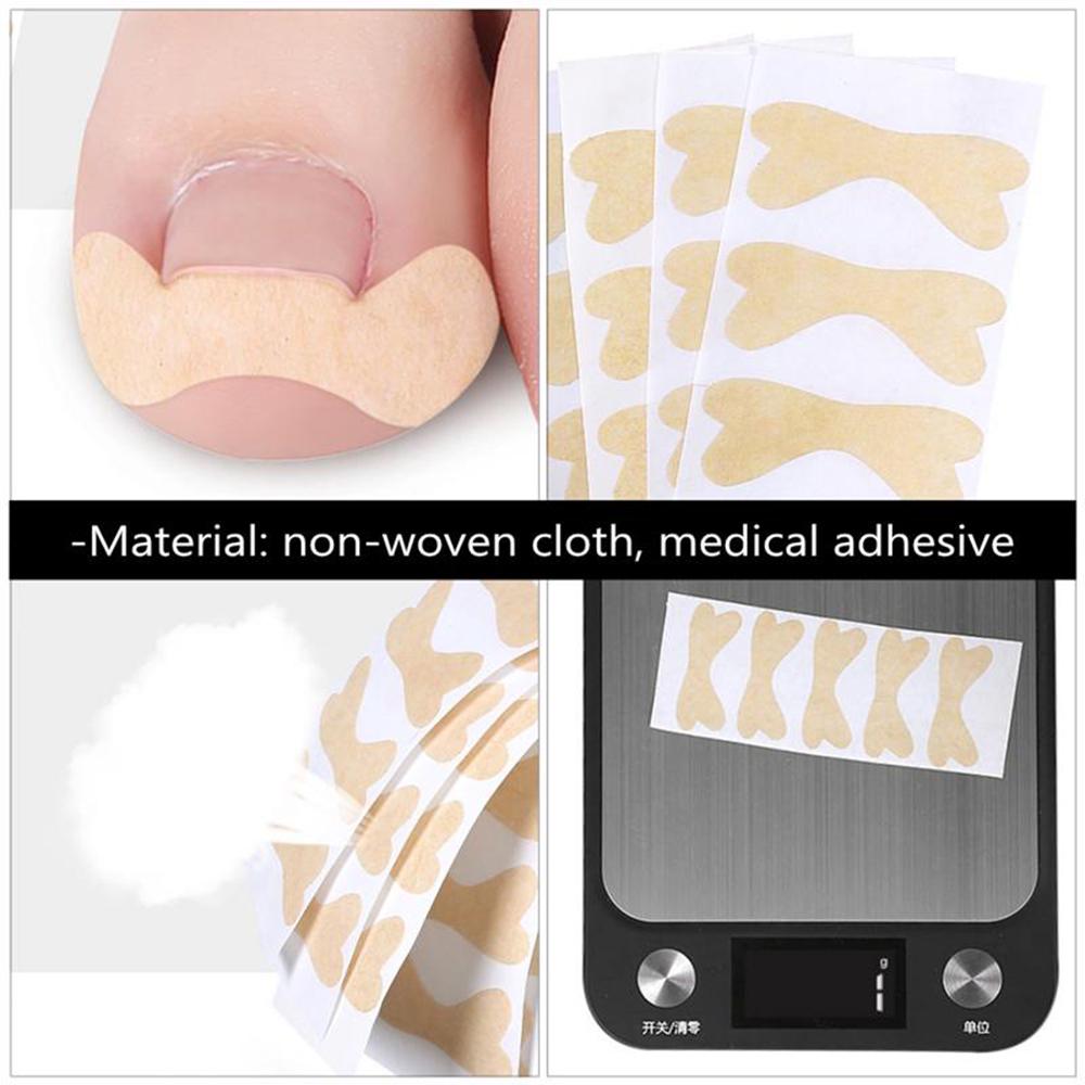 Pedicure tools Nail Care Patch Ingrown toenails  Stickers Toenail Treatment Corrector Stickers