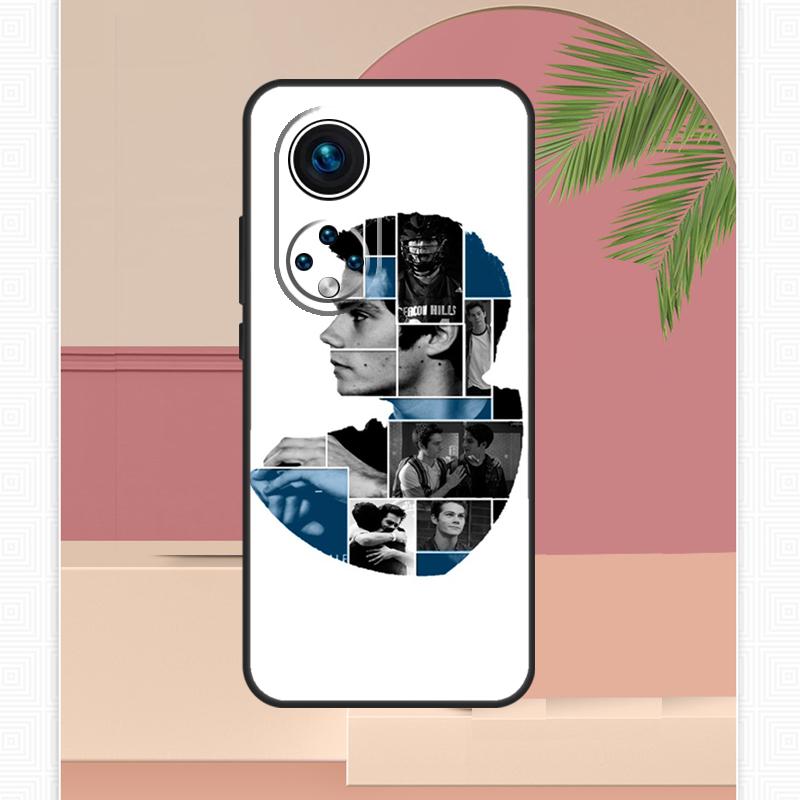Dylan O'Brien Teen Wolf Case For Honor Magic 5 6 7 8 Pro Honor X9c X9b X9a X8b X8a X8c 50 70 90 400 200 Lite Cover
