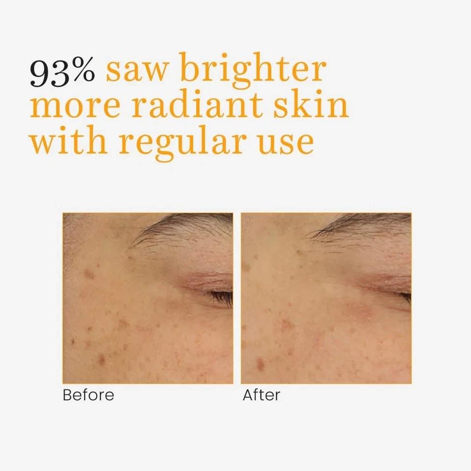 O3+ Vitamin C Turmeric Glow Gel Cream 50g | Brightening Moisturizer