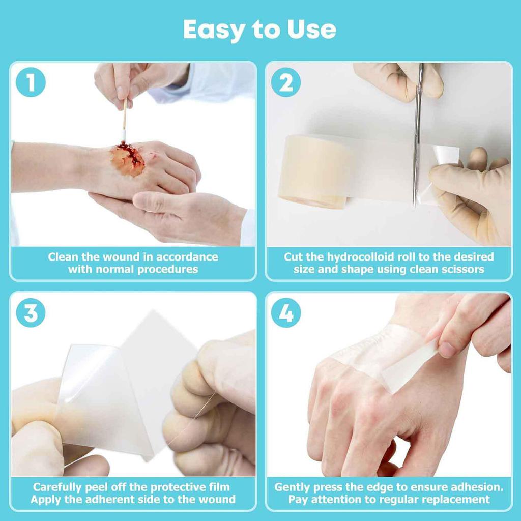 Hydrocolloid Dressing Roll: Moist Wound Healing & Acne Patch