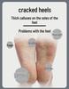 Electric Foot Callus Remover with Digital Display