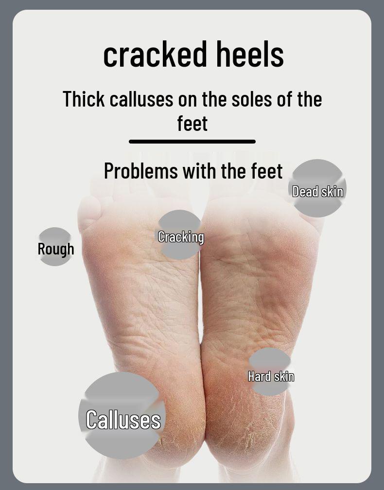 Electric Foot Callus Remover with Digital Display