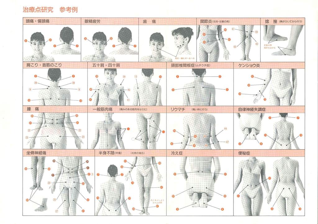 Advanced Low Frequency Therapy Device Windsor for Home Stiff Rehabilitation Clinic Professionals Use the Interferometric Therapy Device Windsor Use,