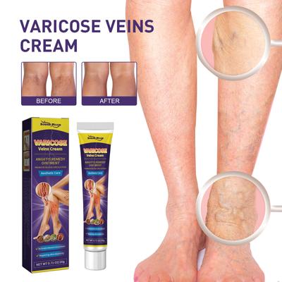 Venoheal Varicose Vein Ease Paste, Varicose Veins Paste, Varicose And Veins Ease For Legs, Improve Blood Circulatio