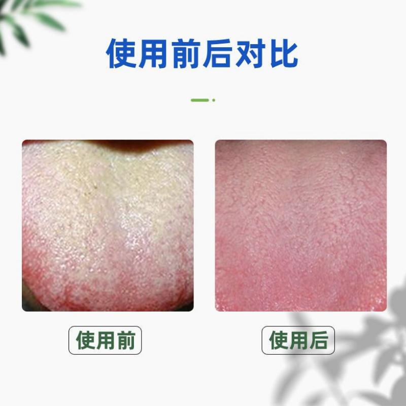 New Portable Tongue Coating Cleaning Brush Stainless Steel Tongue Scraper Deodorant Artifact Cleaning Tongue Coating Oral Tools