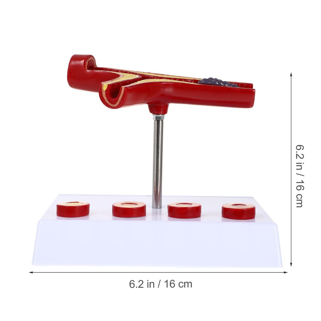 Pvc Cardiovascular Model Science Atherosclerosis Display Hospital Teaching Supplies Anatomical Models Physiology