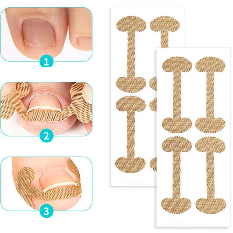 Ingrown Toenail Correction Strips Lasting Adhesion Waterproof Nail Correction Stickers Elasticity Toe Care Pedicure Tools