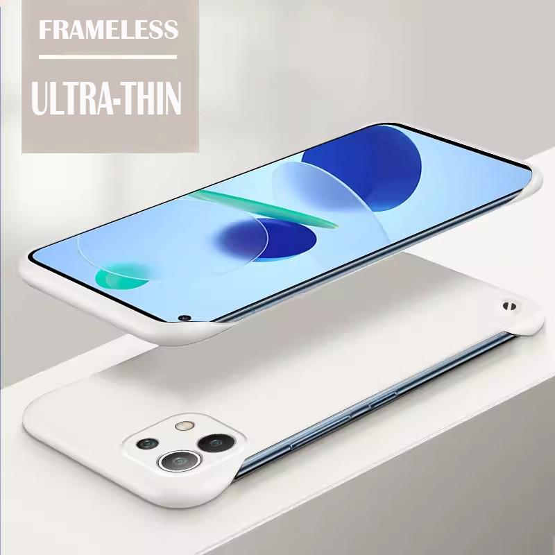

Твердый чехол-накладка из твердого ПК цвета конфет без рамки для Xiaomi Mi 11 Lite Coque 11T 11 Ultra Pro, ударопрочный, ультратонкий чехол Mi 11 Ultra слоновая кость
