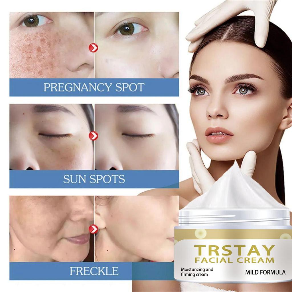 Whitening Moisturizer, Brightens Skin Tone, Moisturizes, Lightens Dullness, Tightens Skin