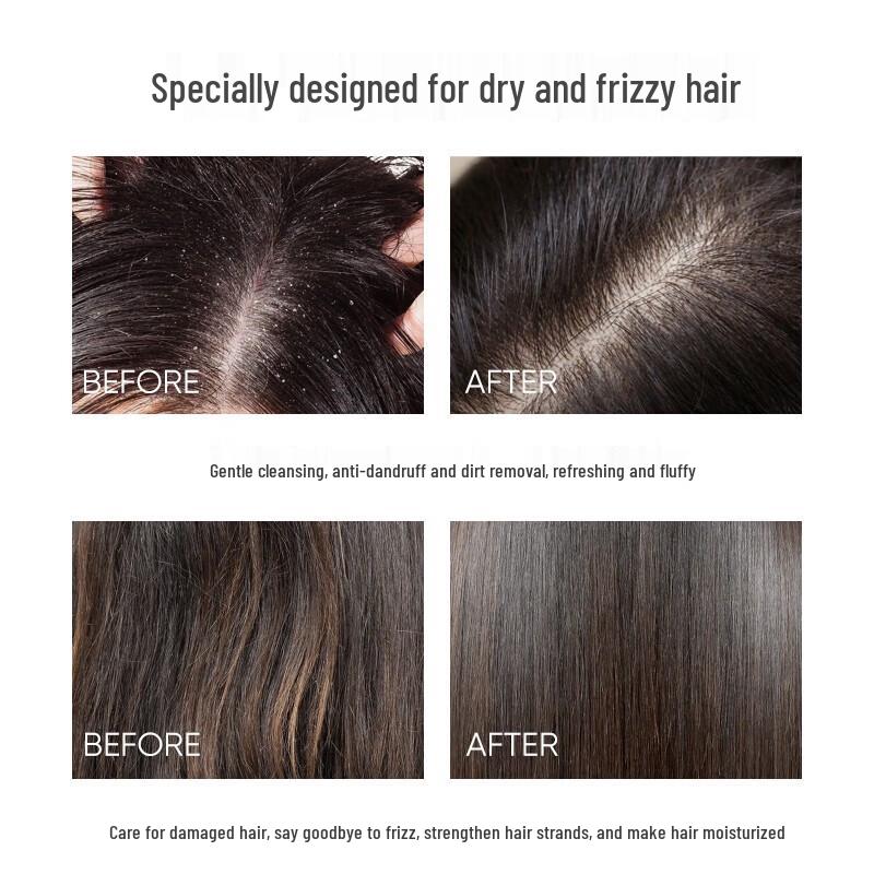 OBEIS Silky Smooth Anti-Dandruff Shampoo