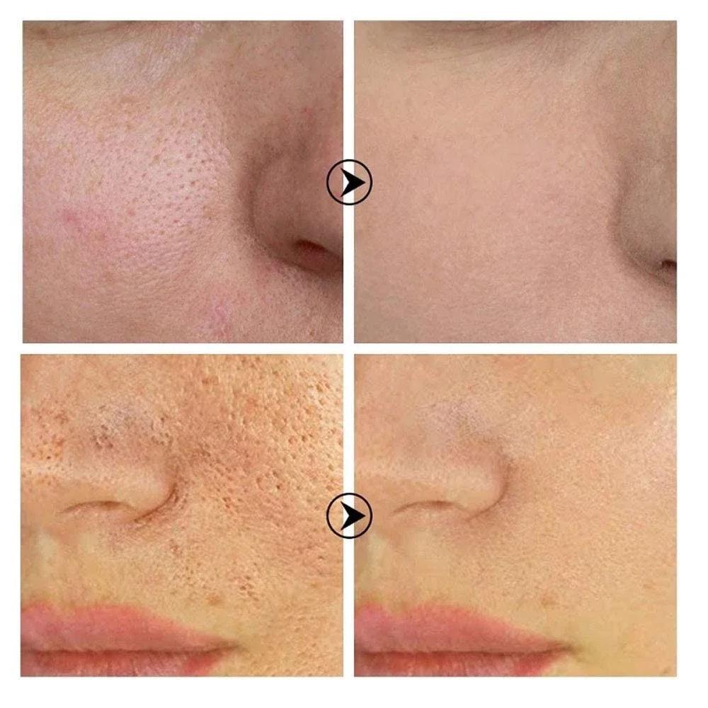 Siero Viso Levigante e Affinante dei Pori con Retinolo e Niacinamide Illuminante Non Comedogeno