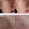 TOSOWOONG Arbutin 7% Tranexamic Acid 4% Cream 50ml Brightening K-Beauty 2025