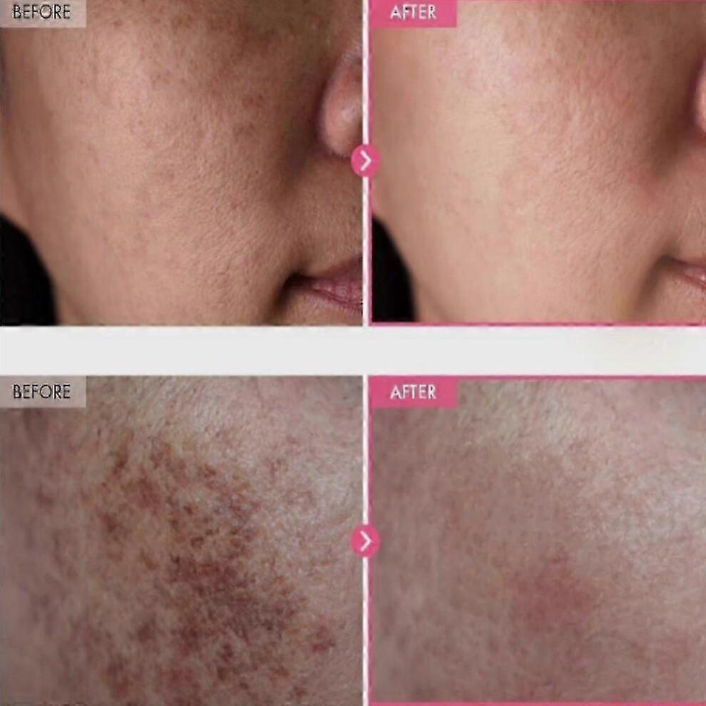 TOSOWOONG Arbutin 7% Tranexamic Acid 4% Cream 50ml Brightening K-Beauty 2025