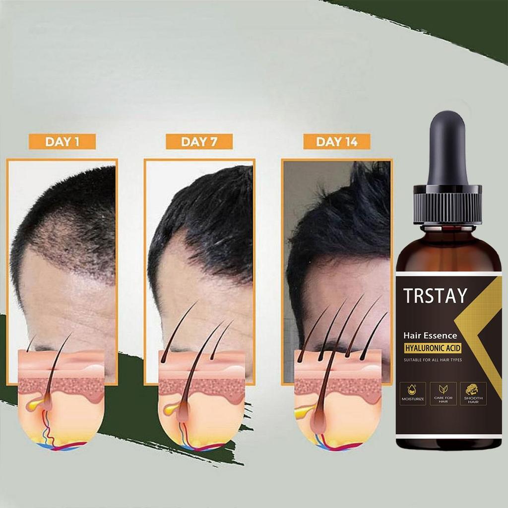 Ingweröl, natürliche Pflanzenessenz, Haarpflege für die Kopfhaut, Vorbeugung gegen Haarausfall, Essenzöl, frei von Haarausfall, Haarpflege- und Schönheitstool