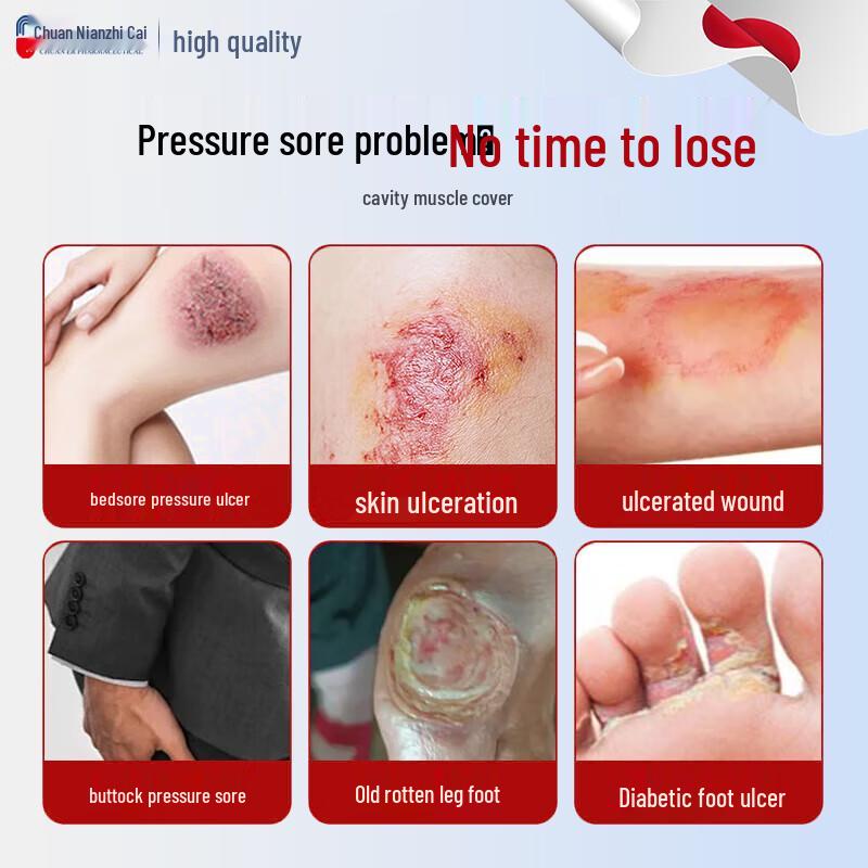 Chuan Nian Bedsore & Pressure Ulcer Healing Cream
