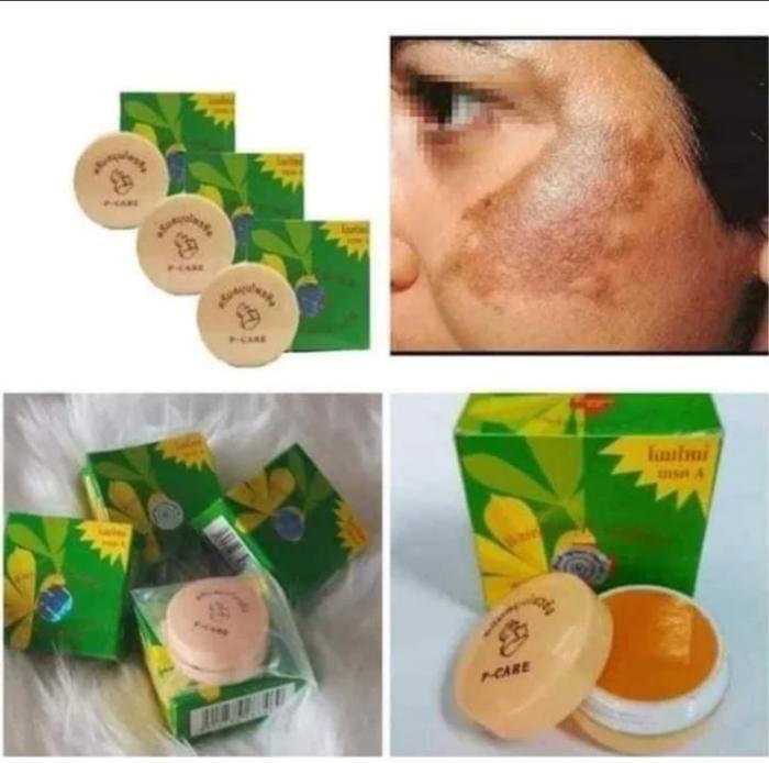 Crème de visage - P-CARE - Anti-hyperpigmentation - 3 pots de 15 g - Sans parfum - Mixte