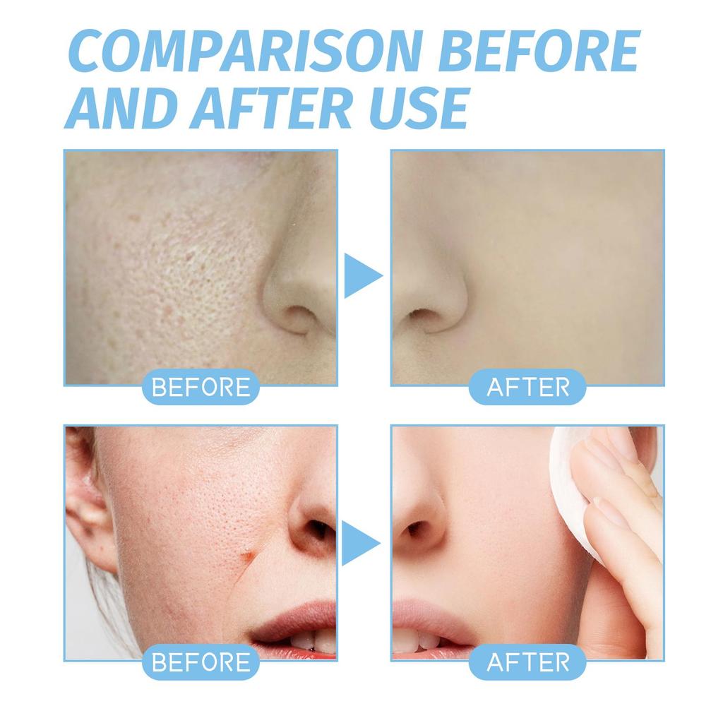 Copper Peptide Serum Anti Aging Fade Fine Lines Pore Shrinking Smoothing Firming Hydrating Hyaluronic Acid Moisturizing Essence