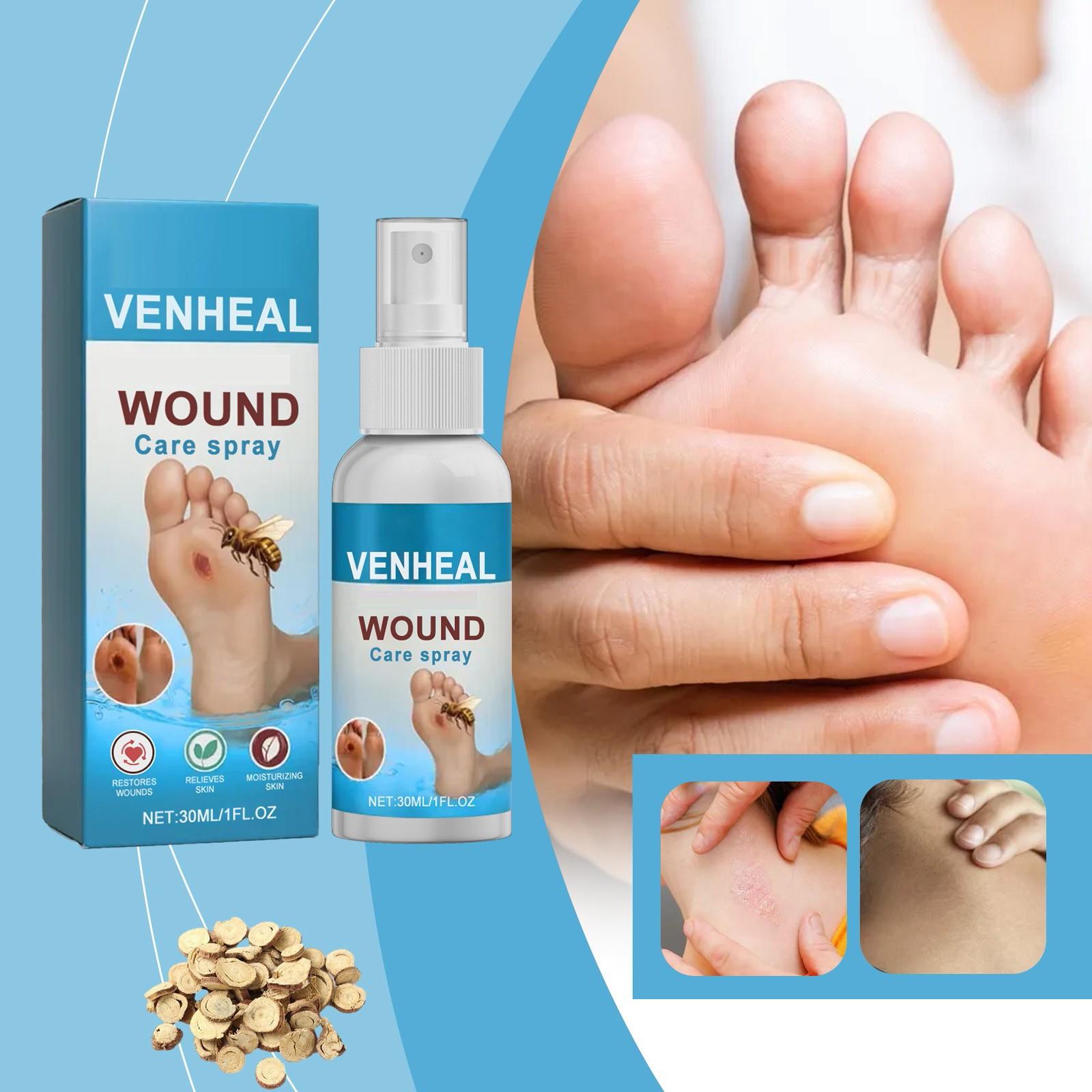 30ml Bedsore Care Spray Relieves Diabetic Skin Infections Herbal Ingredients One Size