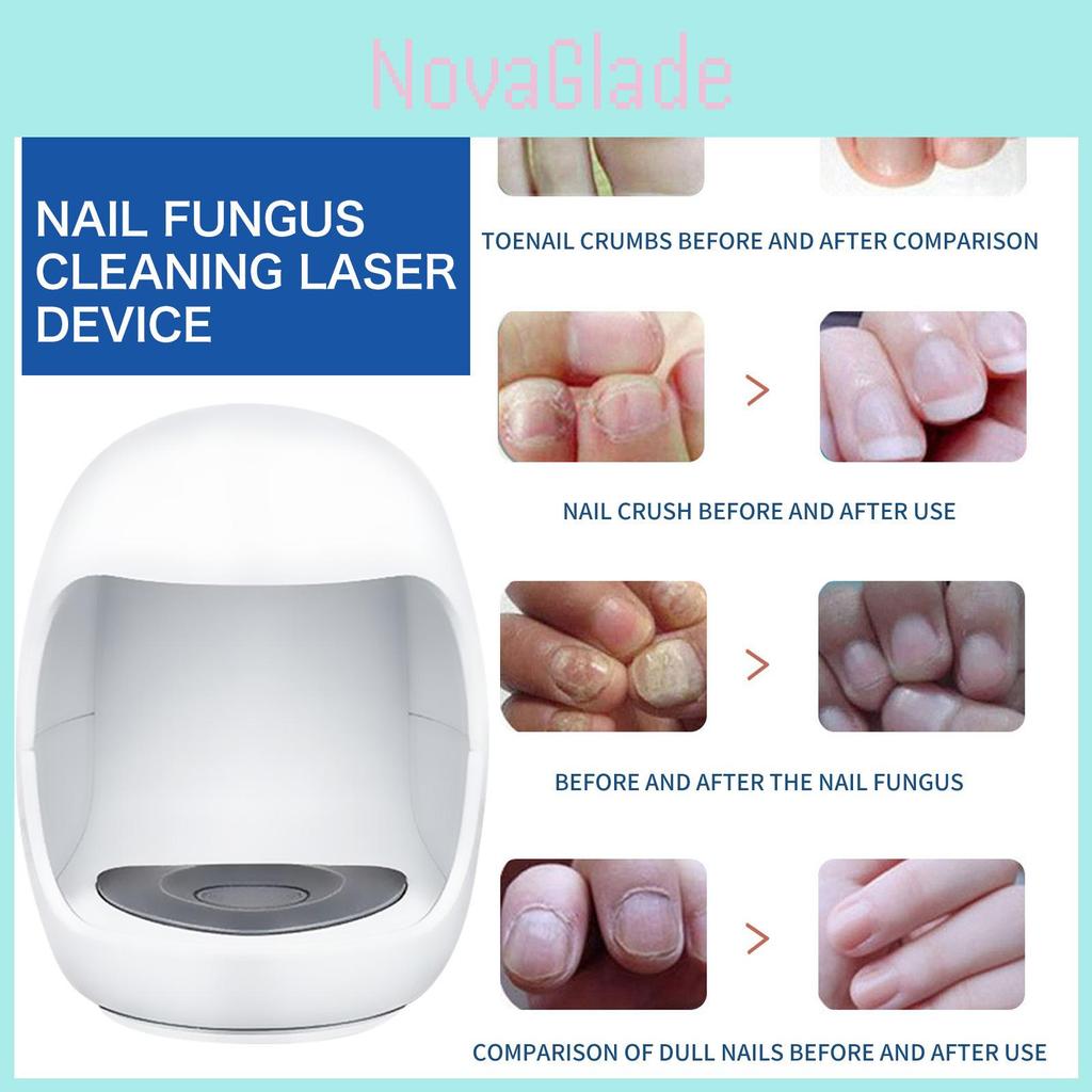 South Moon Nail Care Light Therapy Device For Repairing Yellowing Nails And Ingrown Toenails