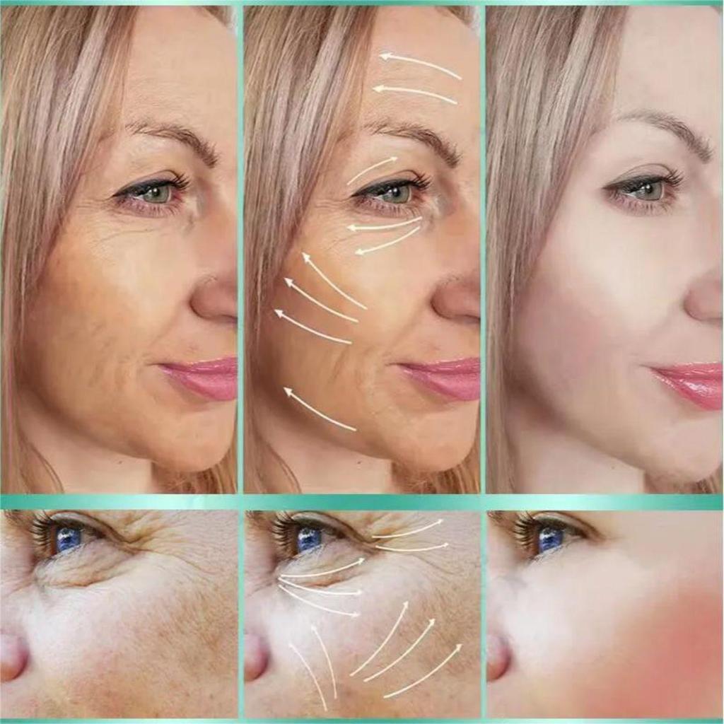 Brightening Anti-aging Cream, Slows Down Collagen Loss, Rejuvenates Skin, Reduces Wrinkles, and Anti-aging