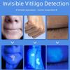 Wood's Lamp Ultraviolet UV Skin Analysis Tool Personal Beauty Care Skin Care Magnifying Analyzer for Daily Beauty Use