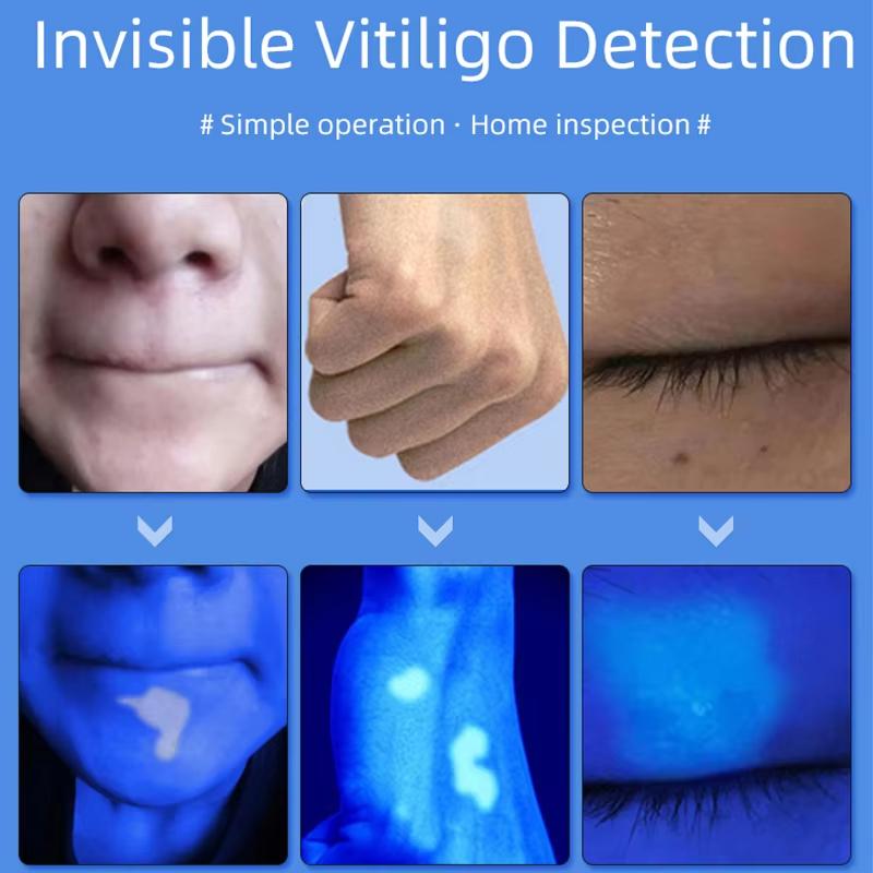 Wood's Lamp Ultraviolet UV Skin Analysis Tool Personal Beauty Care Skin Care Magnifying Analyzer for Daily Beauty Use