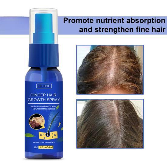 30ML Ginger Hair Growth Spray Oil for Hair Care Hair Growth Products Hair Loss