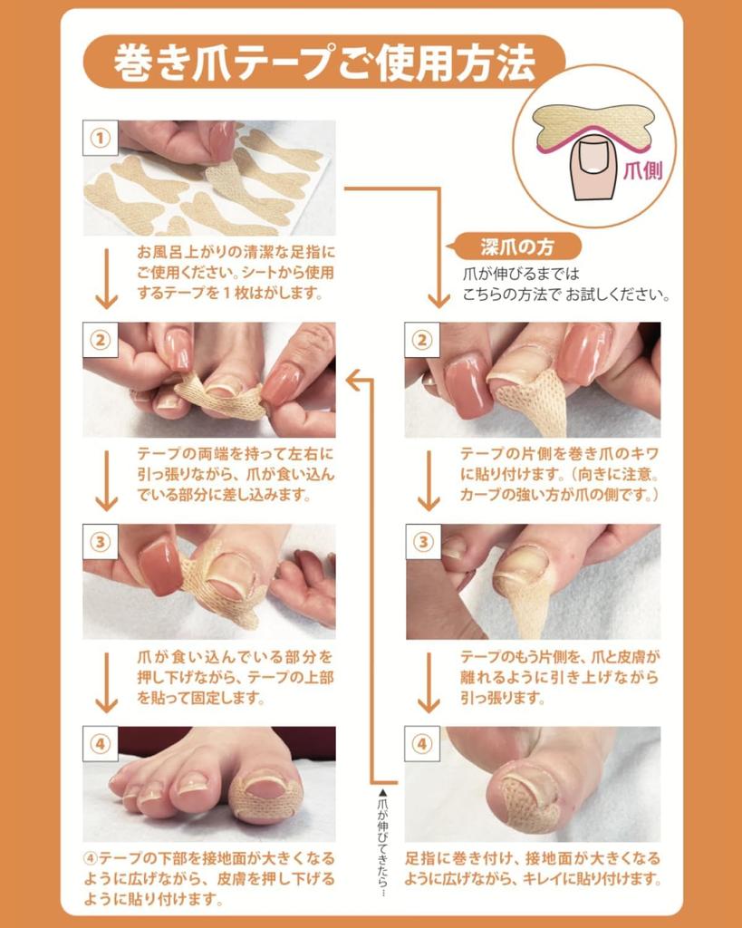 By Ingrown Nail Tsumerakku Ingrown Nail Tape Adhesive X Breathable Easy To Ingrown and Nail Tape Original Foot Comfort Workshop 40 [Supervised