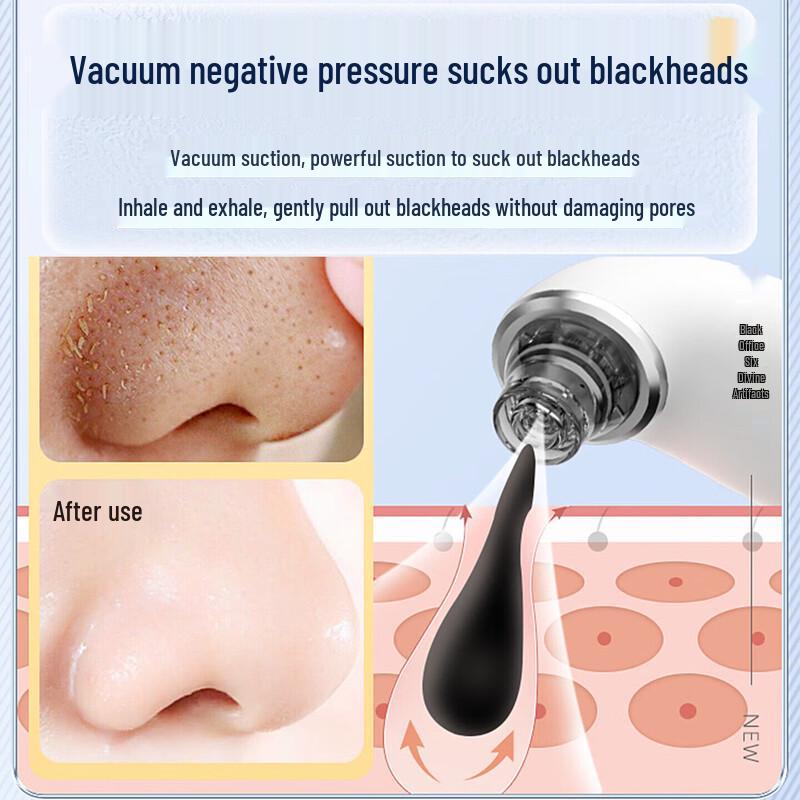 CHIGO Electric Pore Vacuum and Blackhead Remover CN plug (adapter included)