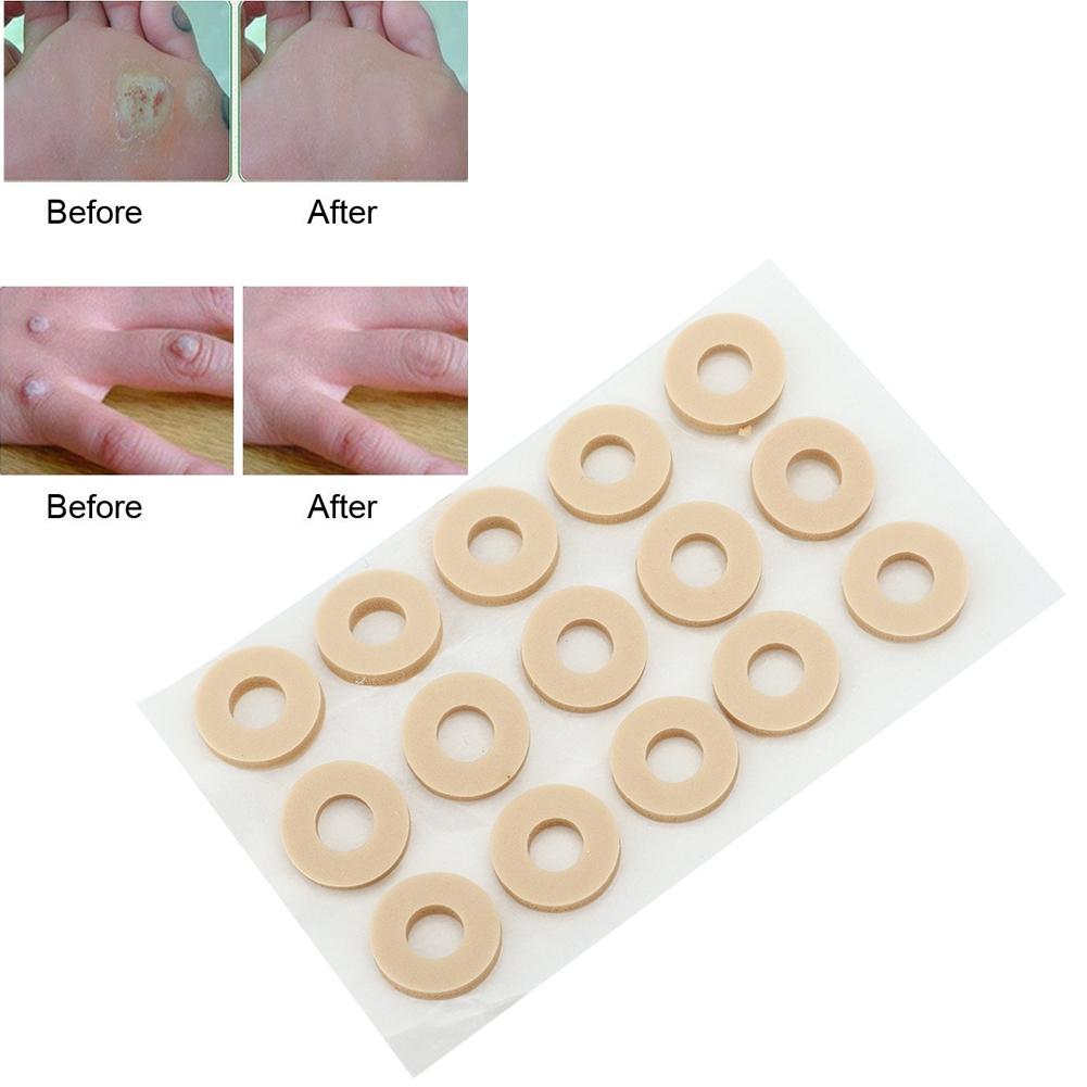 15 Stück Maisentfernungspflaster zur Entfernung von Hornhaut und Schmerzen im Fuß