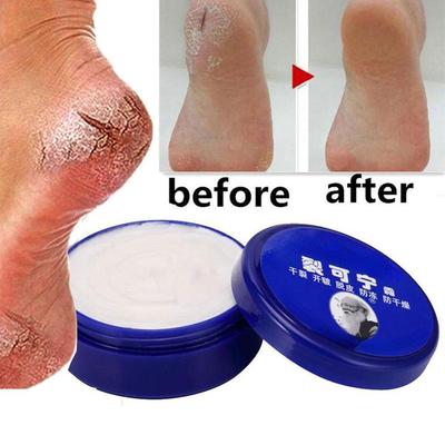 Anti Crack Foot Cream Dryness Foot Heel Cracked Repair Hand Mositurizing Cream Hand Feet Care
