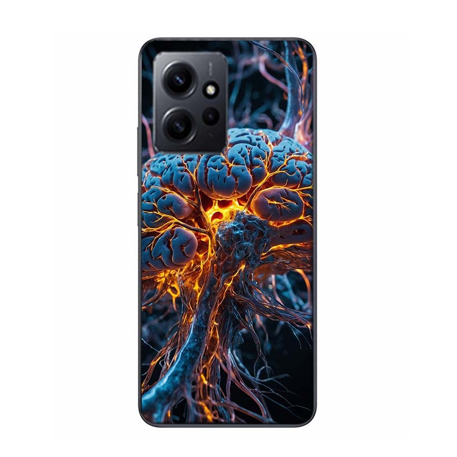 The Cerebral Cortex And Key Components Phone Case For Redmi 12 13C 12C 15C 9 10 10C Note 13 Pro Plus 14 15 Pro 9T 9C 9A TPU Soft