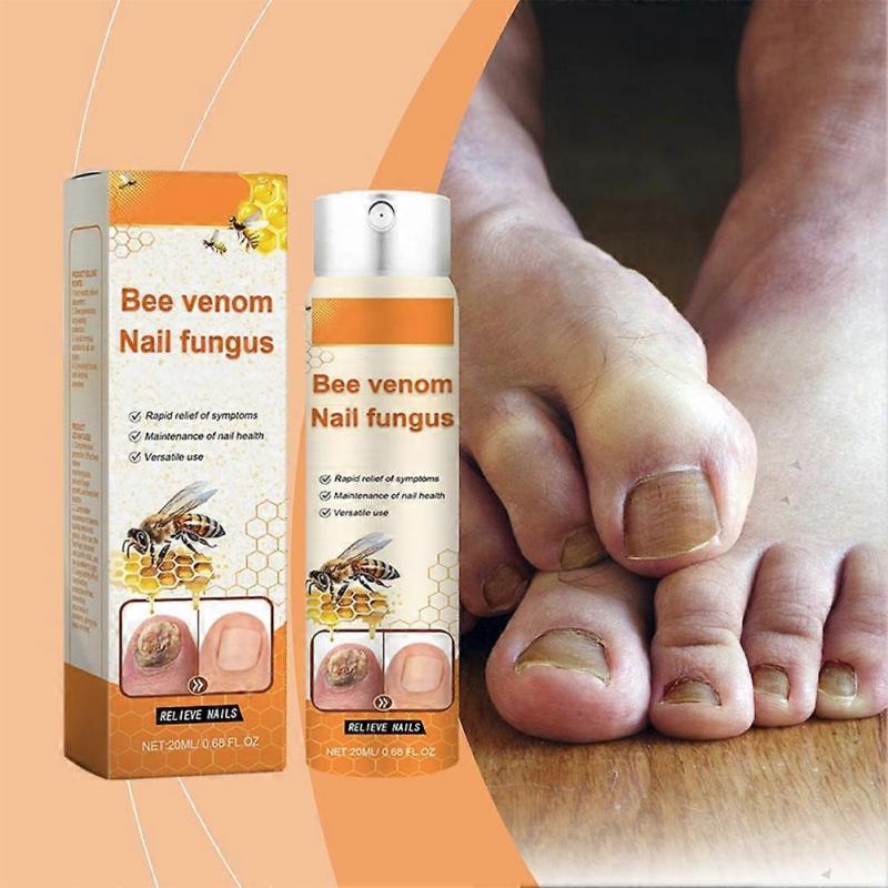 Bee Venom Nail Fungus Treatment Spray 20ml Natural Antifungal Solution for Healthy Nails Fast Acting Odorless