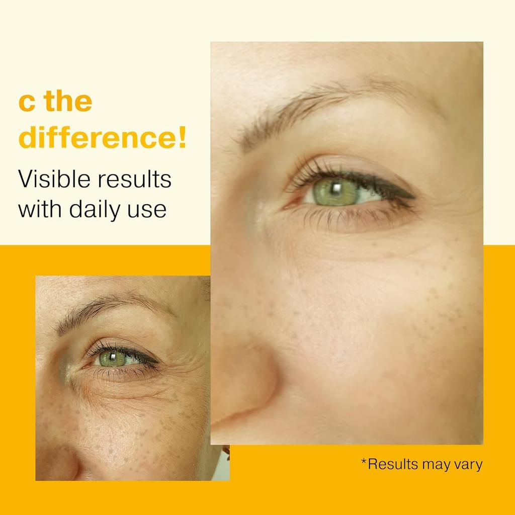 New Vitamin C Concentrate Serum: Vitamin C Serum for Mature Skin, Double Size