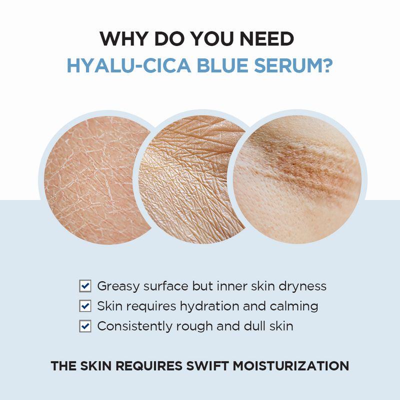 [SKIN1004] Madagascar Centella Hyalu-Cica Blue Serum 50ml