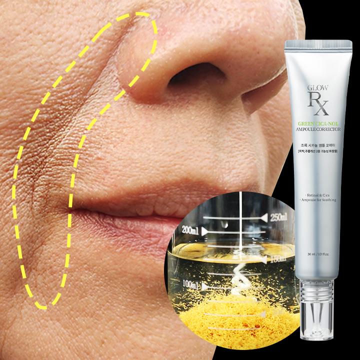 

Топическая ампула с зеленым ретинолом и нитями Ulthera Shot