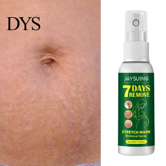 Treatment Remover 30ml Stretch Mark Spray Fast Absorption Moderate Effective Long Lasting Fade Non-Pungent Repair Damage Gentle Removal for Home Acne