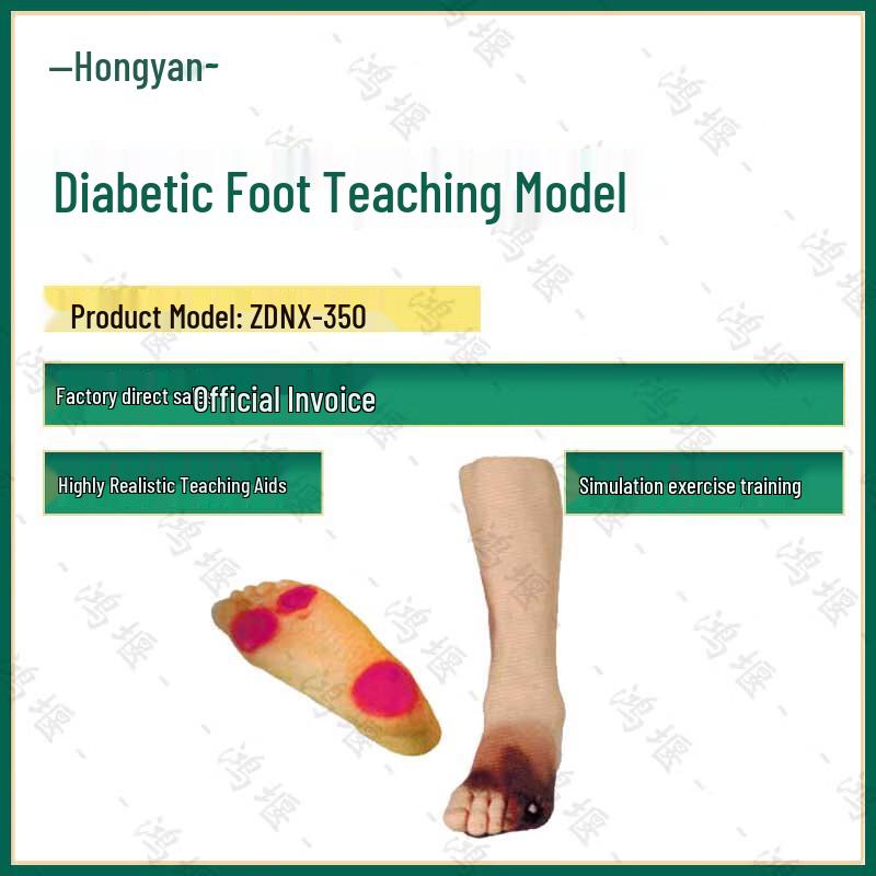 Diabetic Foot Teaching Model