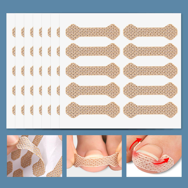 10Pcs Breathable Ingrown Toenail Correction Patches Stickers Self-Adhesive Nail Straightener Strips for Toenail Care