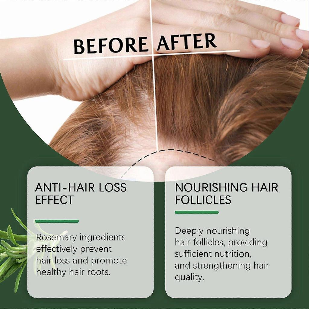 Rosemary Softening Hair Care Oil Nourishes Hair Follicles, Strengthens Hair